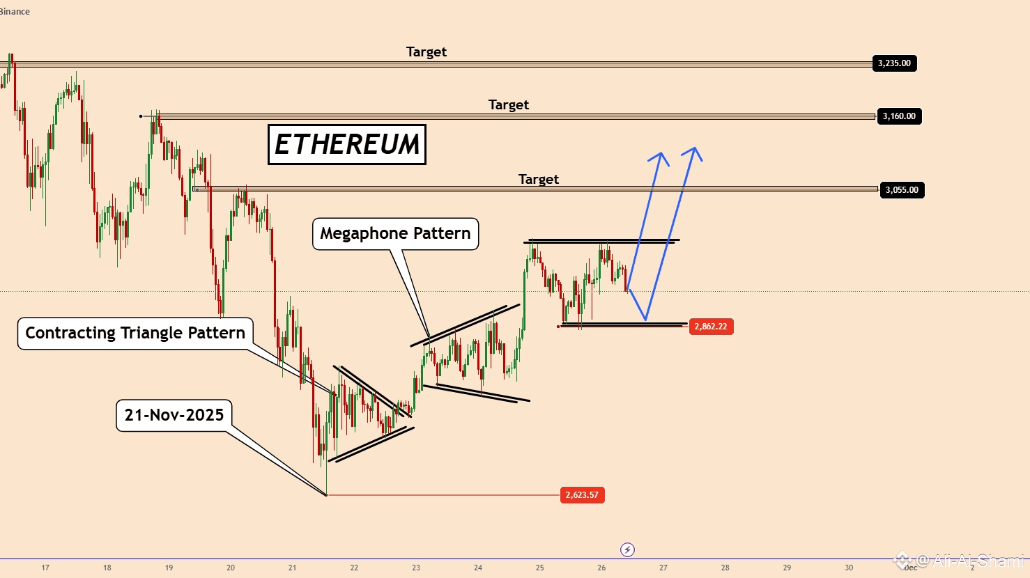 Ethereum: Pattern after Pattern — Bulls Prepare to Continue🤑 | Ali Al ...