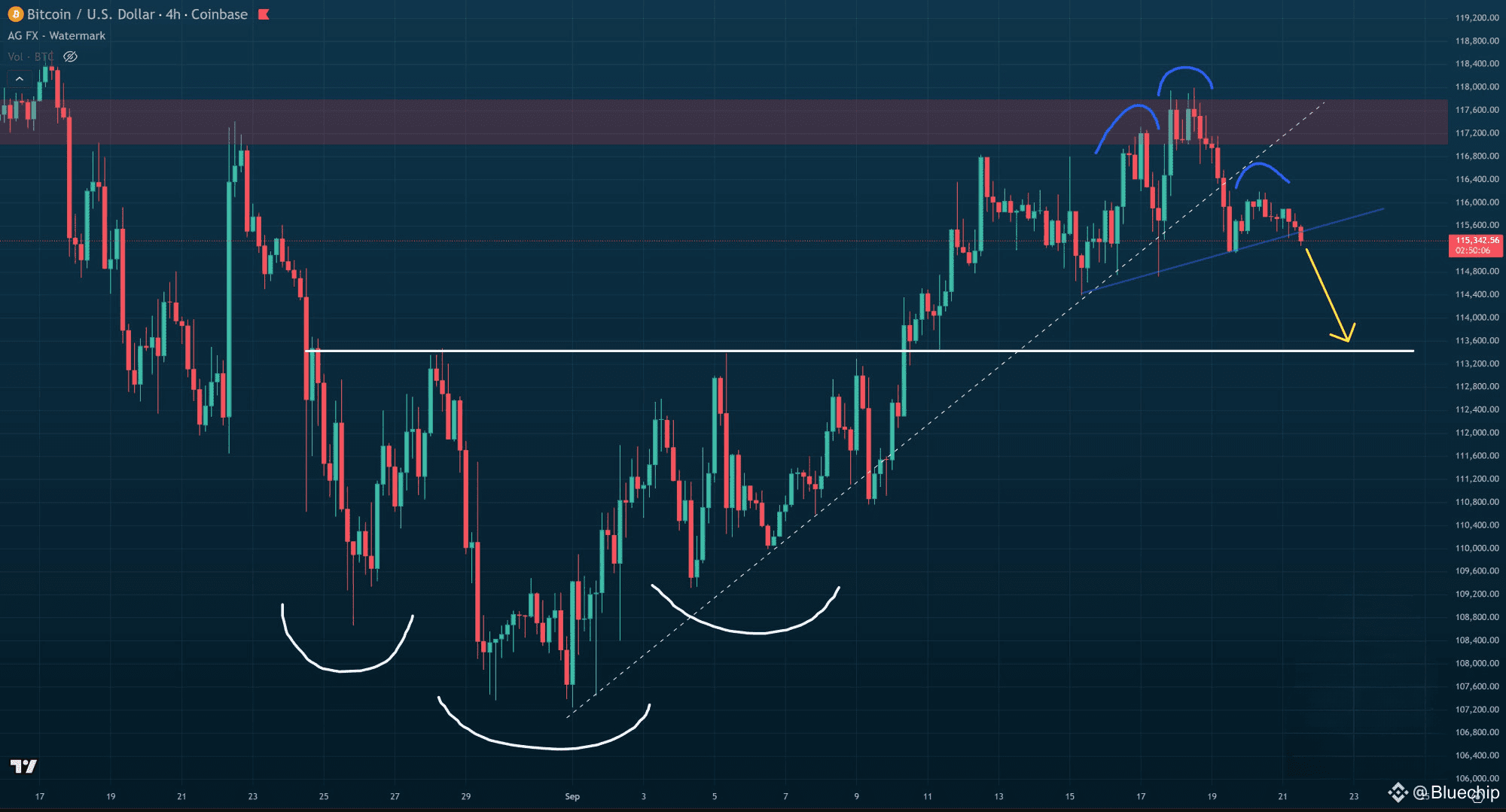 Ratio Cedear Cotizacion Cedear Pfizer Precio De Hoy De Bitcoin